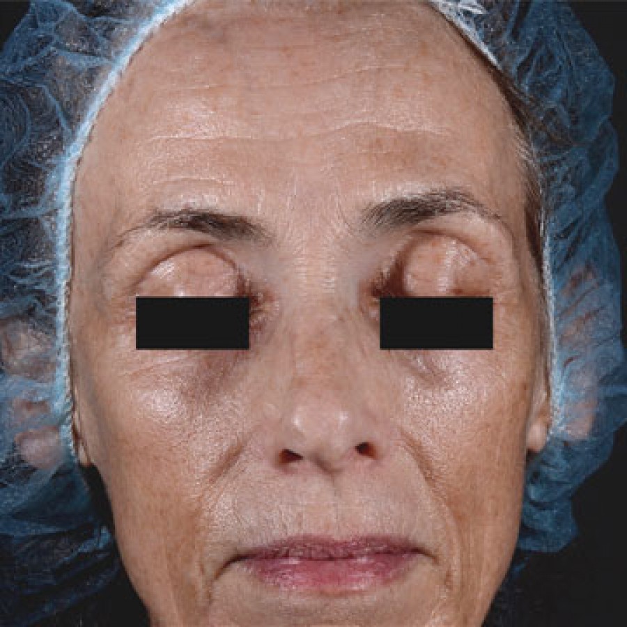 ThreeForMe - After 1