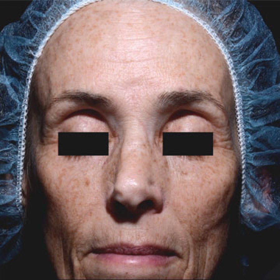 ThreeForMe - Before 1