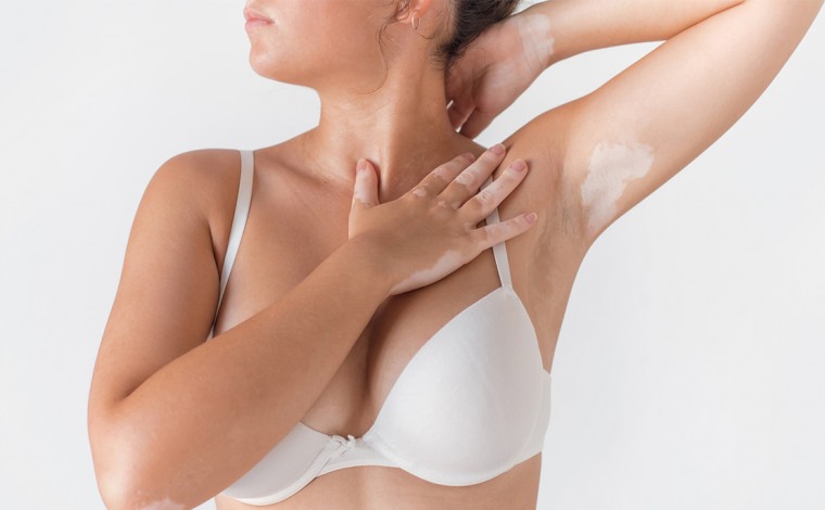 1110x685 Header May Electrolysis